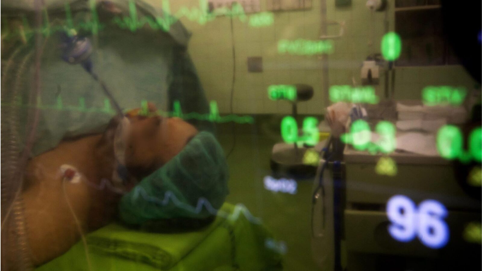 O escândalo que gerou revisão nas regras para doação de órgãos nos EUA