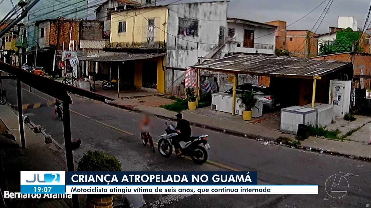Criança de 6 anos perde braço após ser atropelada por motociclista em Belém