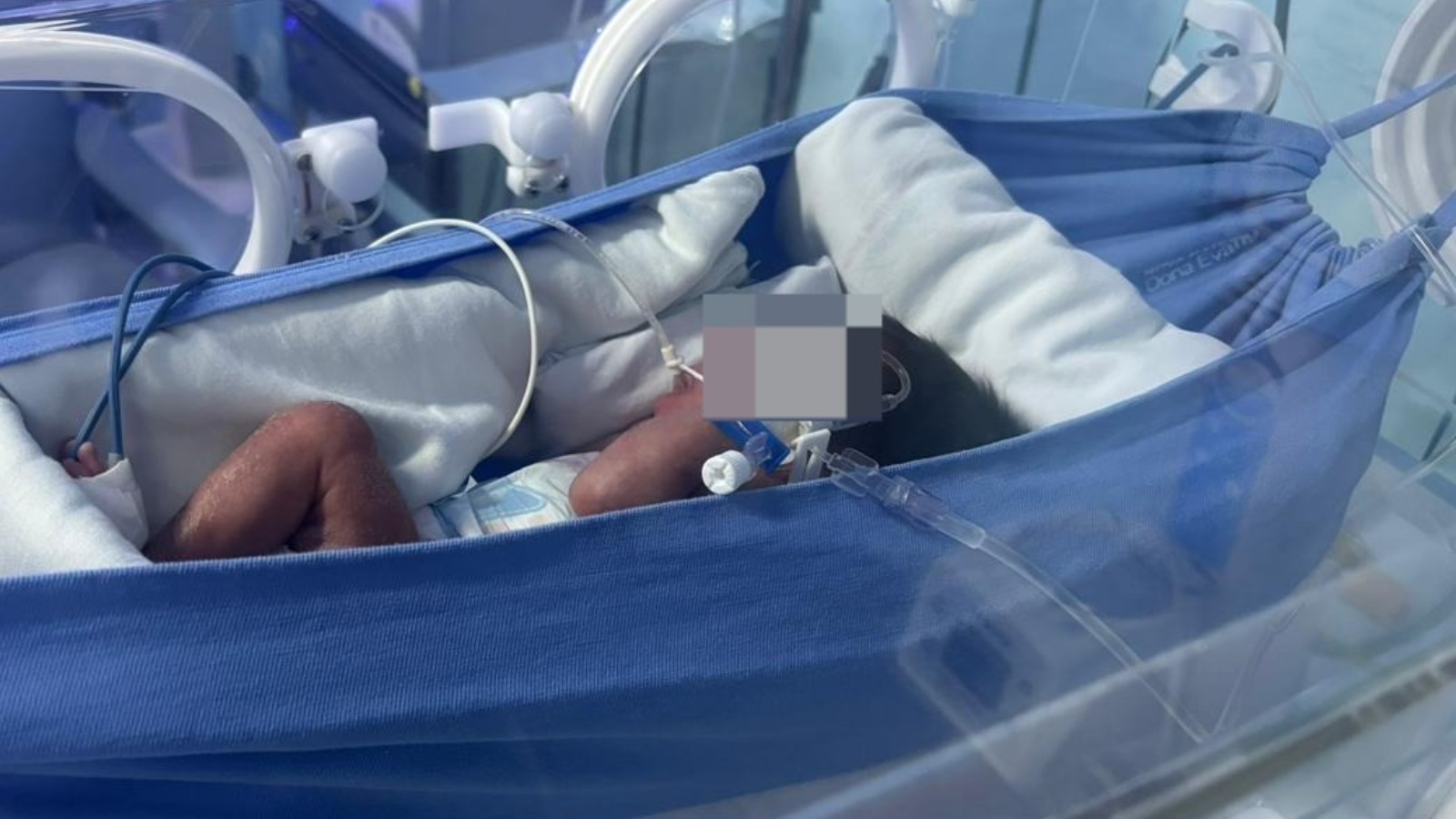 Redinhas ajudam no desenvolvimento e conforto de bebês prematuros no P