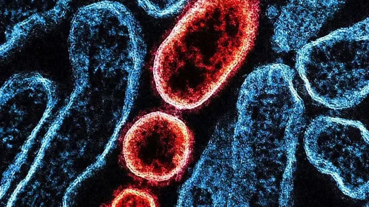 Surto de Nipah no Carnaval? Entenda se há risco para o Brasil