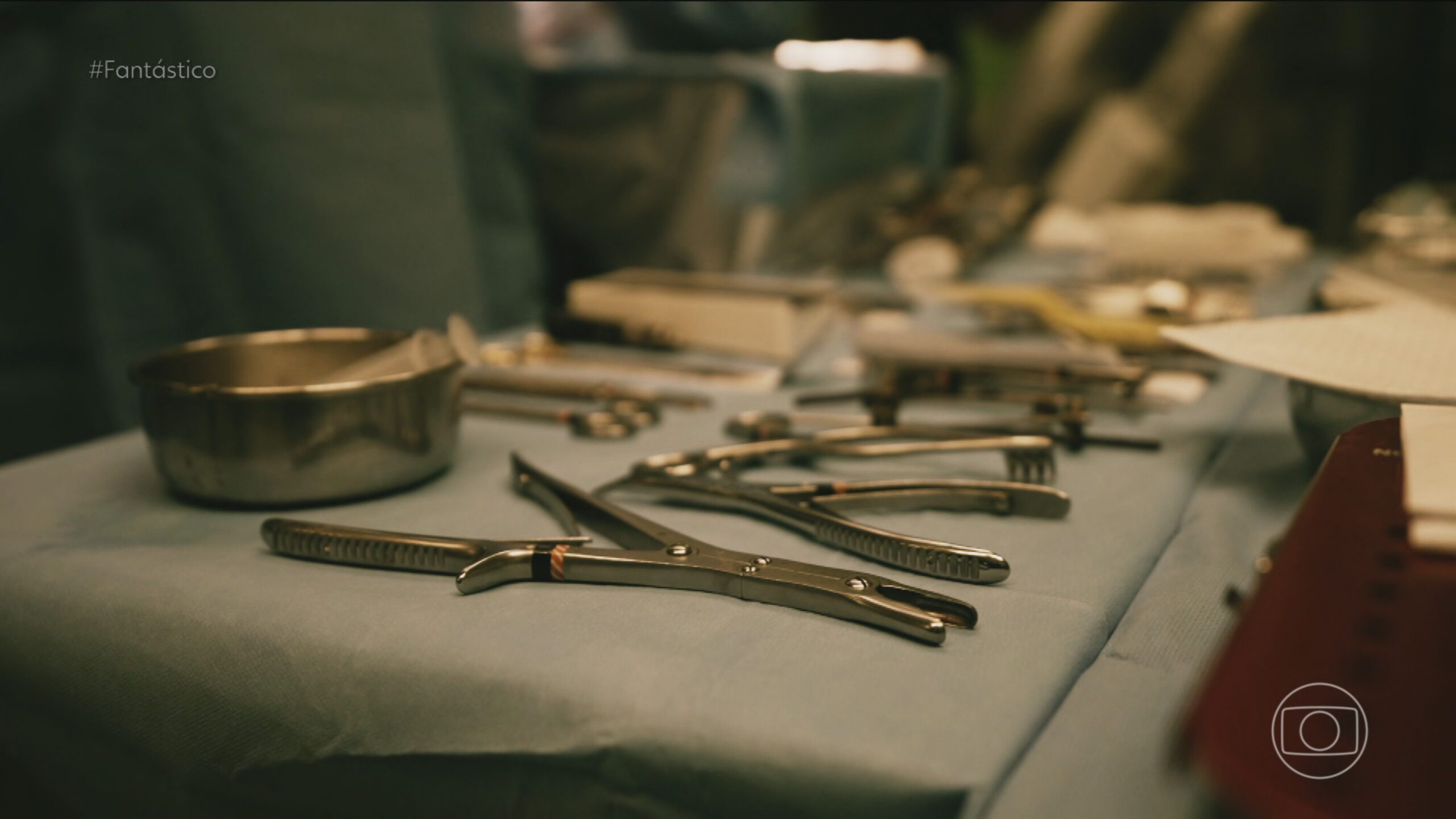 73% dos cirurgiões dizem que já operaram algum paciente para retirada de um corpo estranho, aponta levantamento da USP