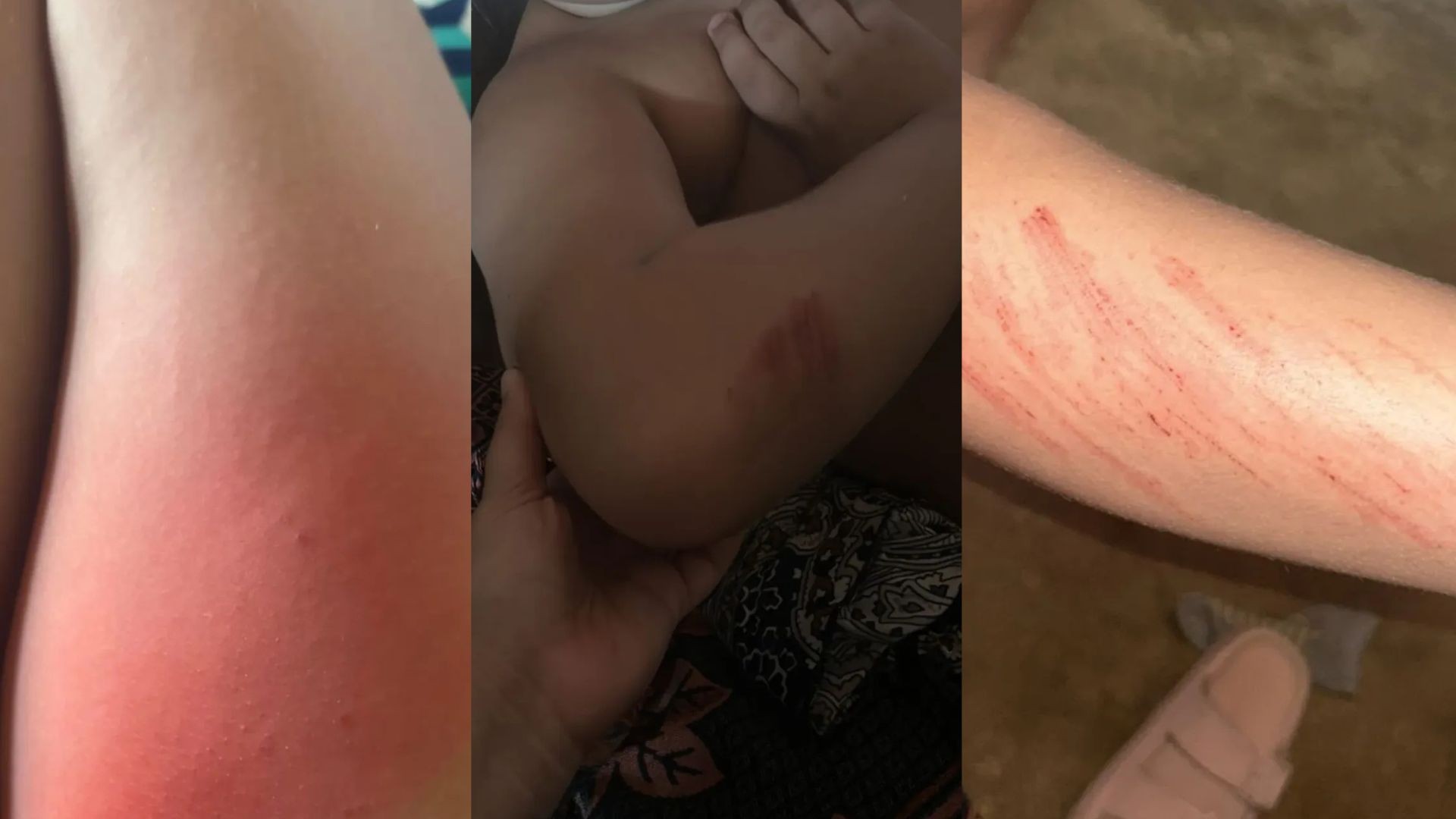 Família denuncia agressão a criança autista em escola de Campina Grande