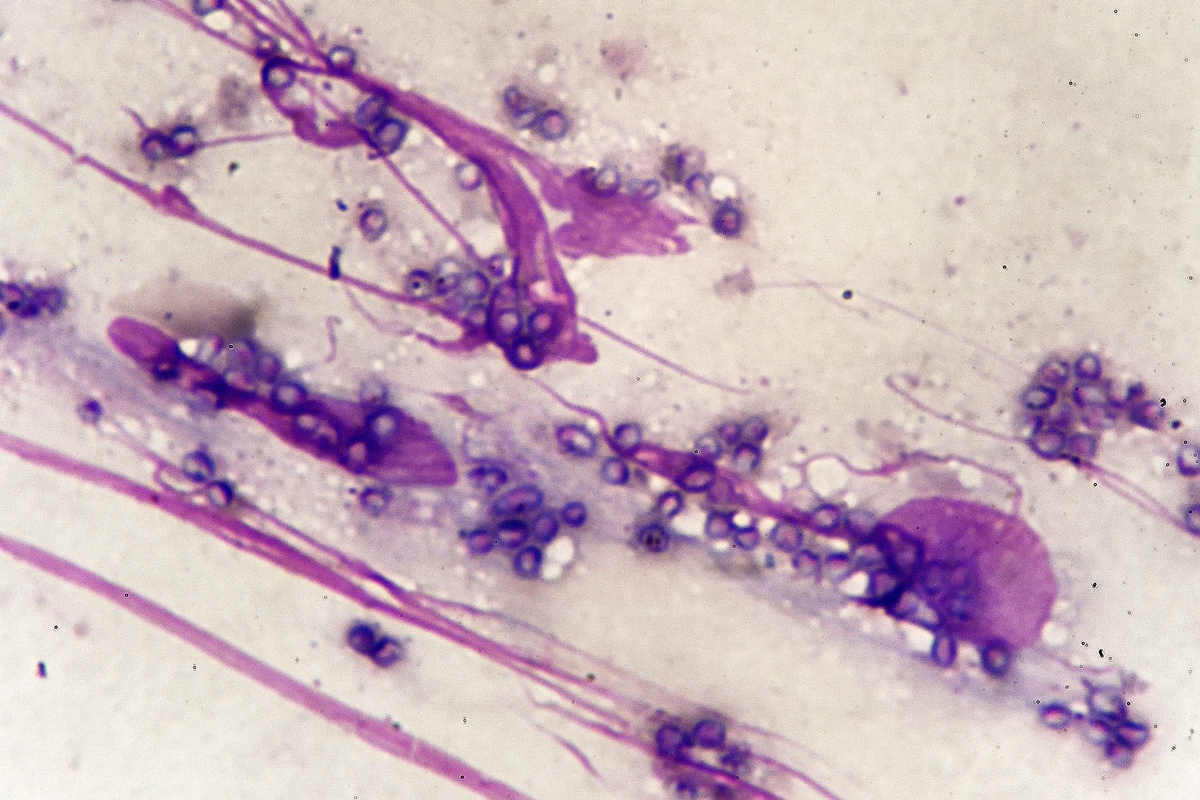 conheça os 5 fungos mais perigosos da natureza