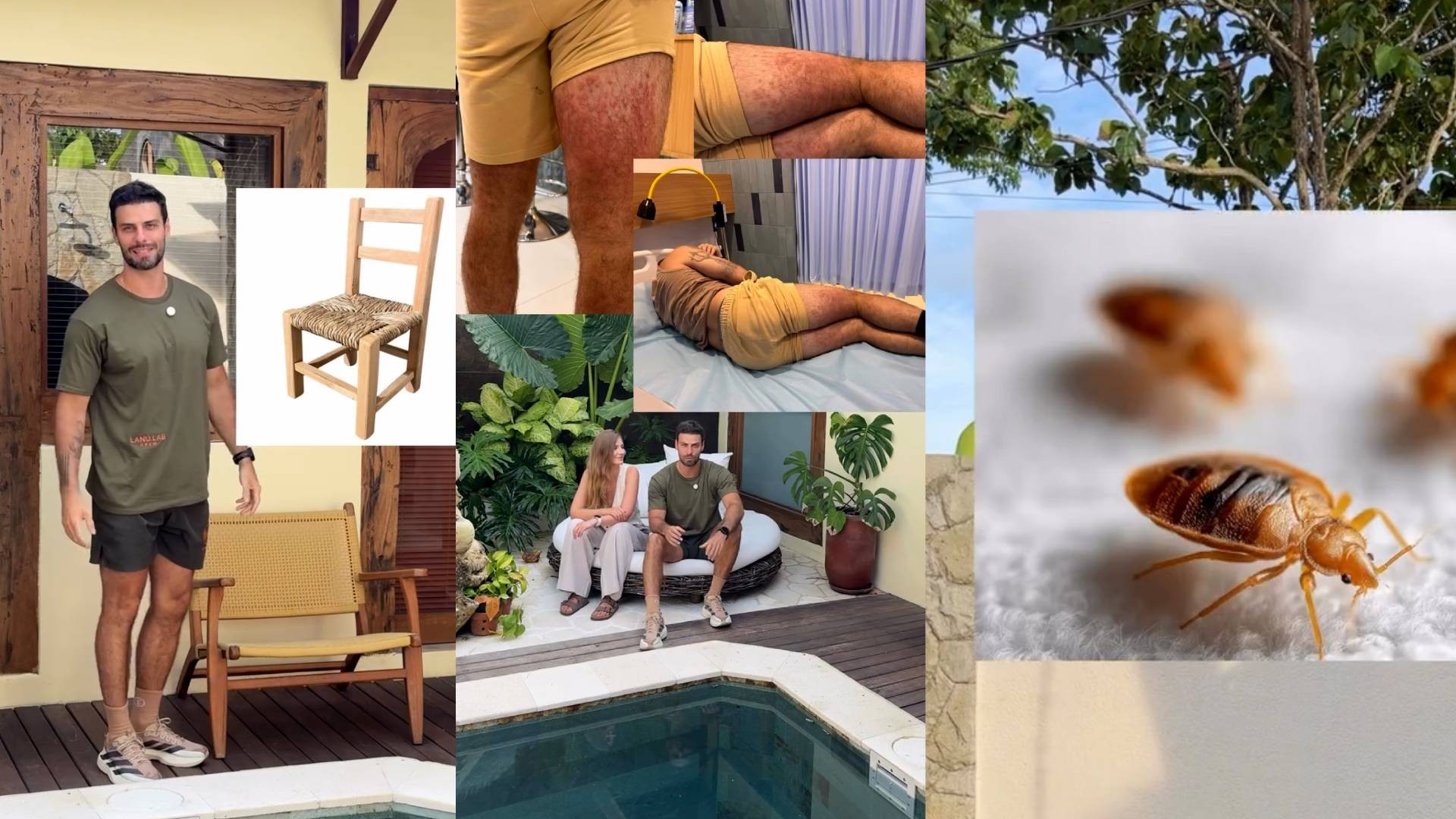 Ator Lucas Malvacini relata susto em Bali após reação alérgica; entenda o que fazer se for picado por artrópodes