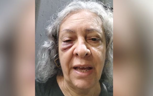 Cantora gospel de 62 anos é agredida com soco em evangelismo