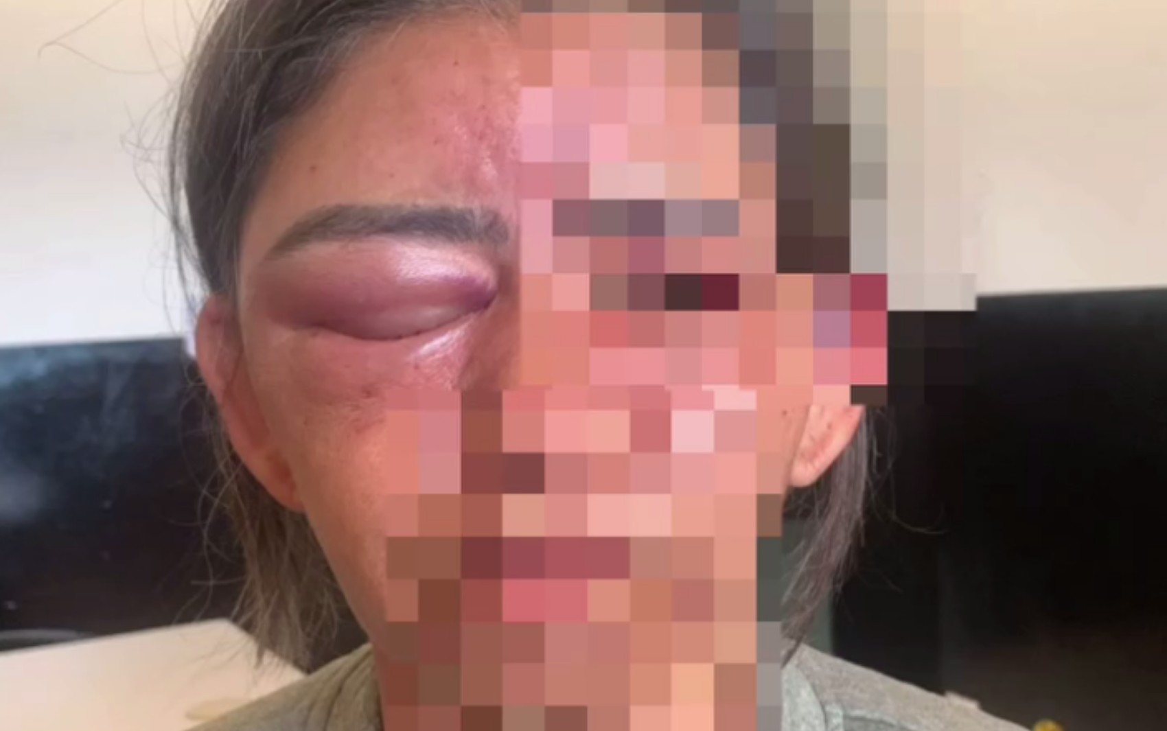 Mulher foi estrangulada e espancada após briga por chave com amigo do filho, diz delegado