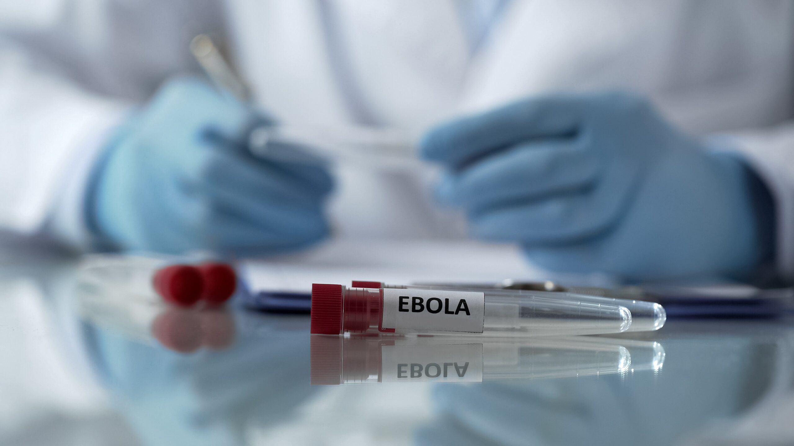 Caso suspeito de ebola é investigado no RS; veja o que já se sabe