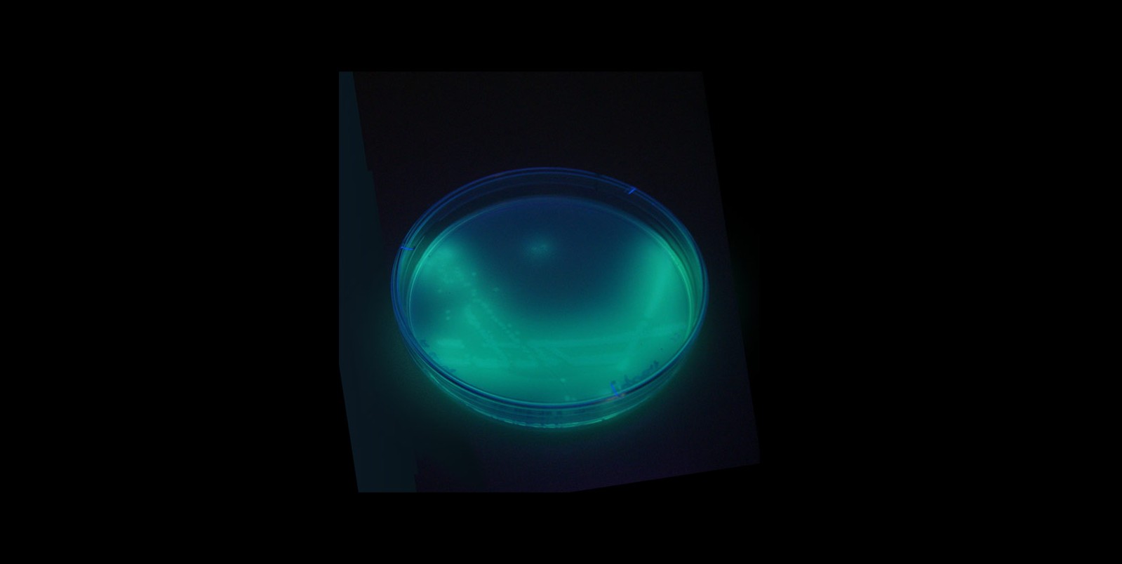 Pseudomonas aeruginosa: o que é a bactéria encontrada em lote de água Crystal e em produtos da Ypê